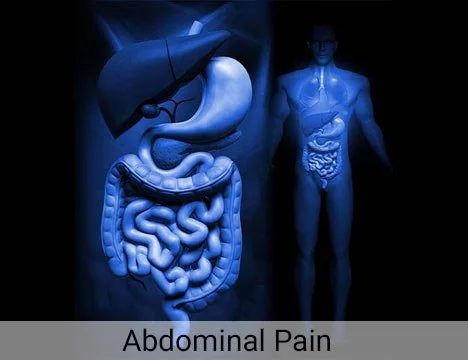 What is Abdominal Pain?