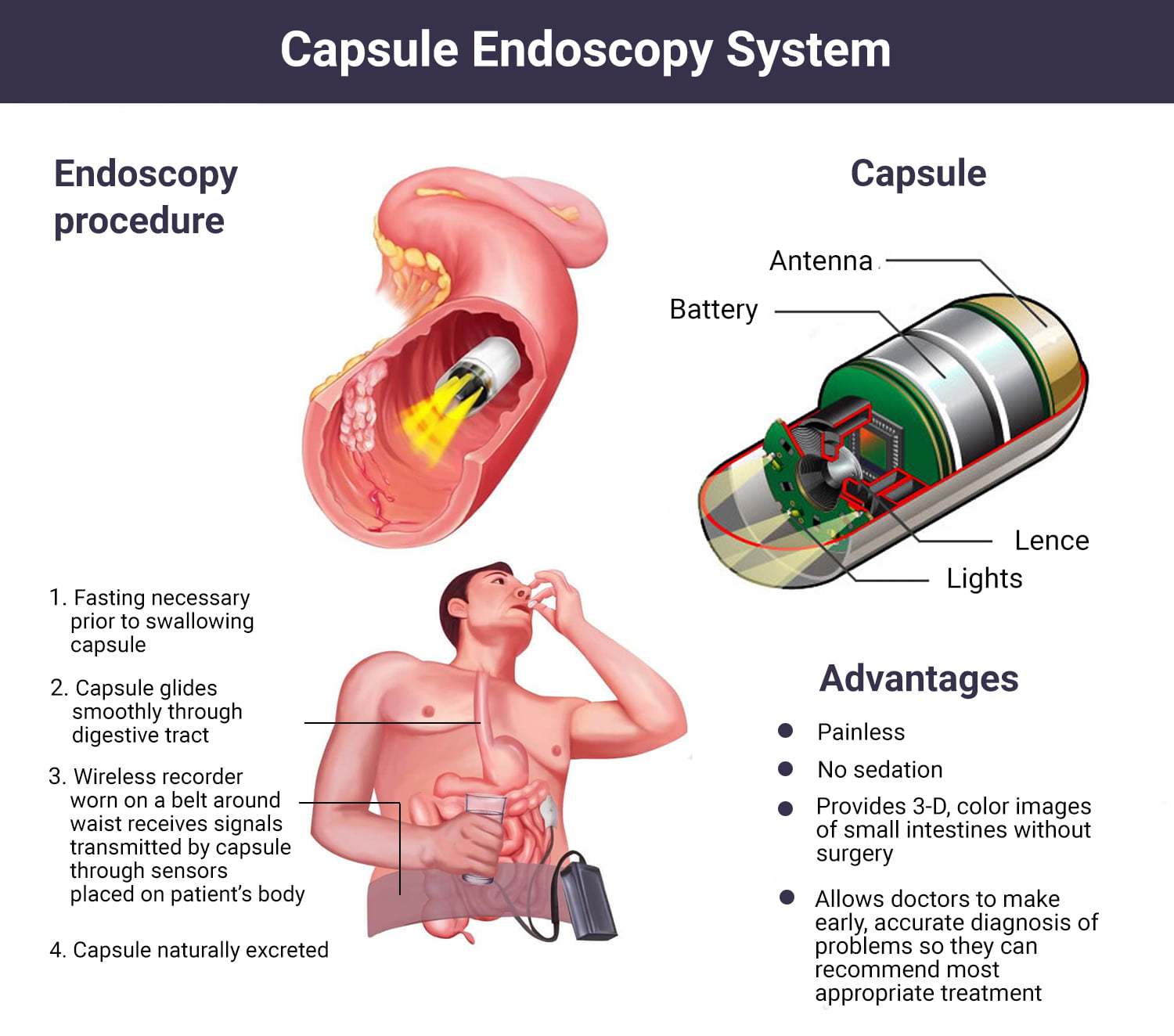 https://www.manhattangastroenterology.com/wp-content/uploads/2022/09/Capsule-Endoscopy-System.jpg